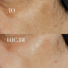 Сироватка із потрійним ретинолом Perricone MD High Potency Triple Retinol Renewal Serum, 59 мл